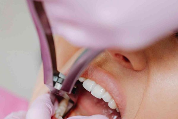 Clinica odontologica en asuncion